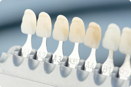 大垣市静里町・かさはら歯科クリニック・セラミック治療